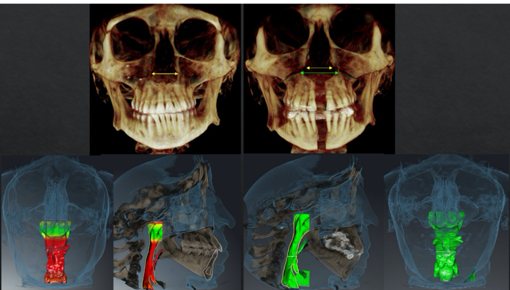 A collage of images of a skullDescription automatically generated