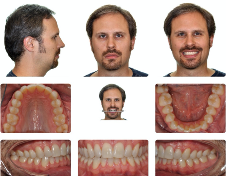 A collage of a person's faceDescription automatically generated