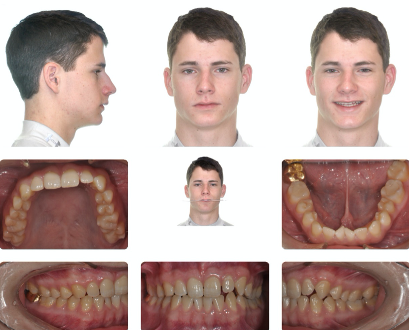 A collage of a person's faceDescription automatically generated