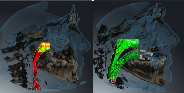 A close-up of a skullDescription automatically generated