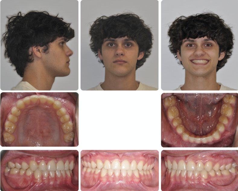 A collage of a person's teethDescription automatically generated