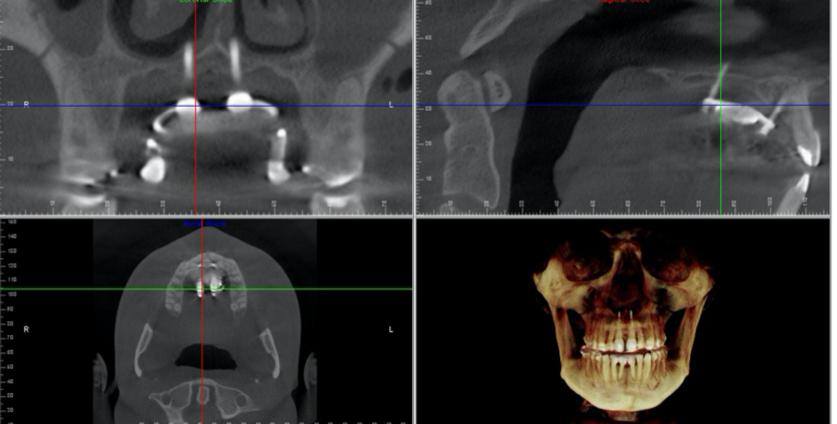 A close-up of x-ray imagesDescription automatically generated