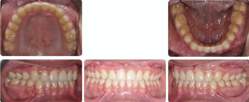 A collage of a person's teethDescription automatically generated